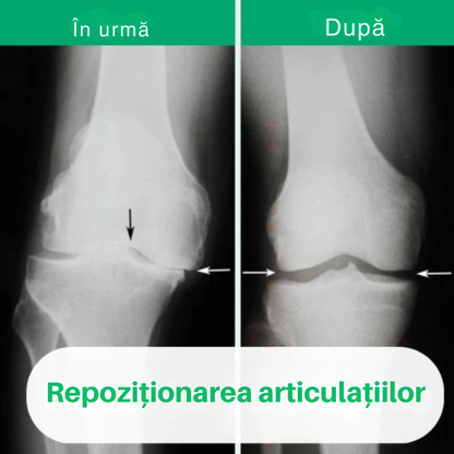 OrthoKnee™ – Ușurare de lungă durată de la artrită și dureri articulare
