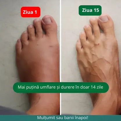 Zenstride® Șosete de compresie respirabile pentru picioare și tălpi fără durere